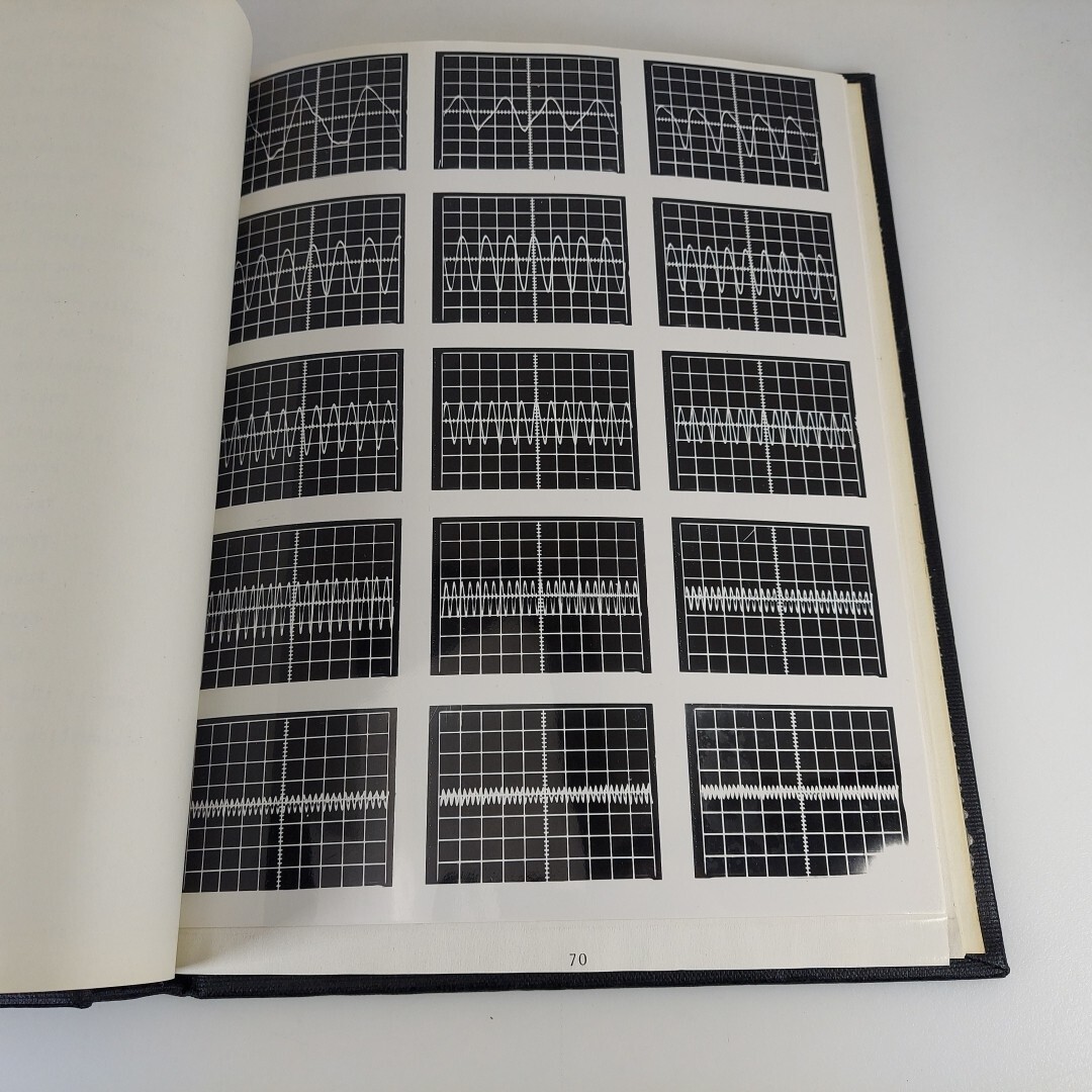 Bound PhD Thesis The Mechanical Resonant Frequency Of The Human Eye In Vivo HC